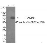 PAK5/6 (Phospho-Ser602/Ser560) Antibody