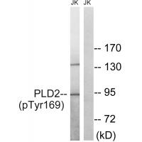PLD2 (Phospho-Tyr169) Antibody