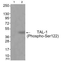 TAL-1 (Phospho-Ser122) Antibody