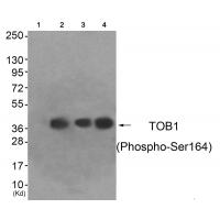 TOB1 (Phospho-Ser164) Antibody
