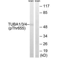 TUBA1/3/4 (Phospho-Tyr272) Antibody