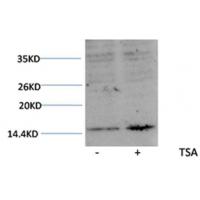 Histone H3(Acetyl-Lys27) Rabbit Polyclonal Antibody