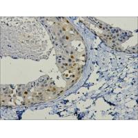 PCNA Mouse Monoclonal Antibody
