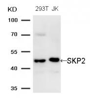 SKP2 (Ab-64) Antibody