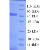 Recombinant human TAR DNA-binding protein 43
