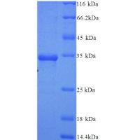Recombinant human Protein argonaute-2
