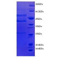 Recombinant Human Protein delta homolog 1