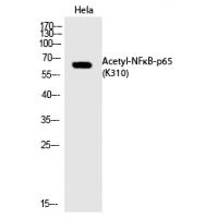 NFκB-p65 (Acetyl-Lys310) Polyclonal Antibody
