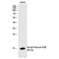Histone H2B (Acetyl-Lys126) Polyclonal Antibody