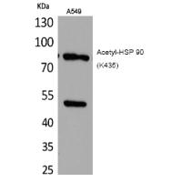 HSP 90 (Acetyl-Lys435) Polyclonal Antibody