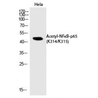 NFκB-p65 (Acetyl-Lys314/Lys315) Polyclonal Antibody