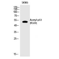 p53 (Acetyl-Lys320) Polyclonal Antibody