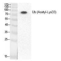 Ub (Acetyl-Lys33) Polyclonal Antibody
