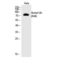 Ub (Acetyl-Lys48) Polyclonal Antibody