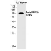 HSP70 (Acetyl-Lys246) Polyclonal Antibody