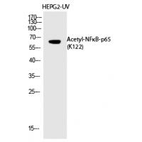 NFκB-p65 (Acetyl-Lys122) Polyclonal Antibody