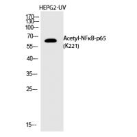 NFκB-p65 (Acetyl-Lys221) Polyclonal Antibody