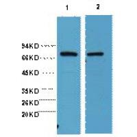 HSP70 Monoclonal Antibody