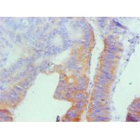 Osteopontin Monoclonal Antibody