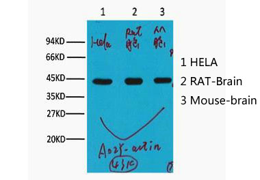 β-actin Monoclonal Antibody(A02)