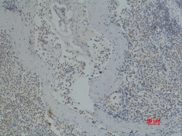 CD41 Monoclonal Antibody(Q90)