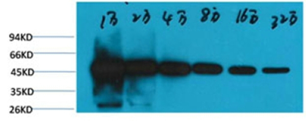 β-tubulin Monoclonal antibody(5G3)