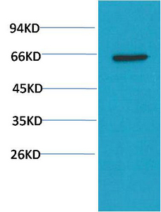 AKT Mouse Monoclonal Antibody(10D6)