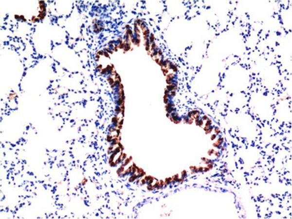 TGFβ1 Mouse Monoclonal Antibody(5D2)