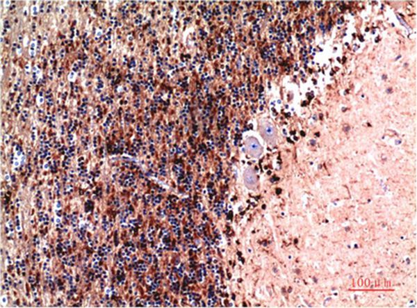 Cystatin C Mouse Monoclonal Antibody(7F11)