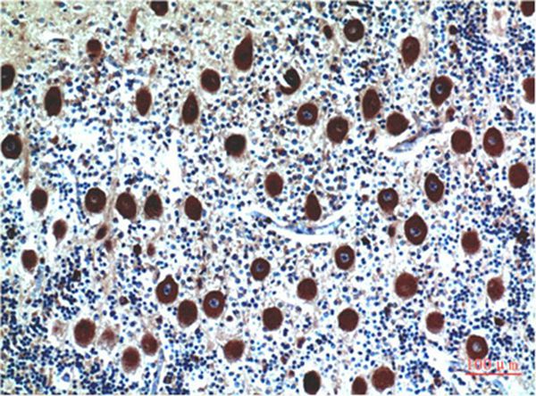 Cystatin C Mouse Monoclonal Antibody(5F1)