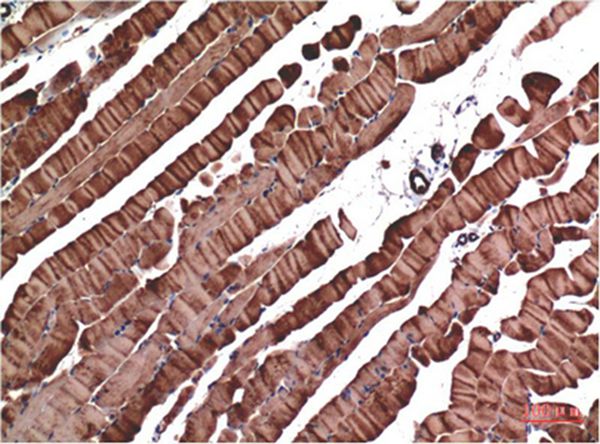 Muscle actin Mouse Monoclonal Antibody(1E9)