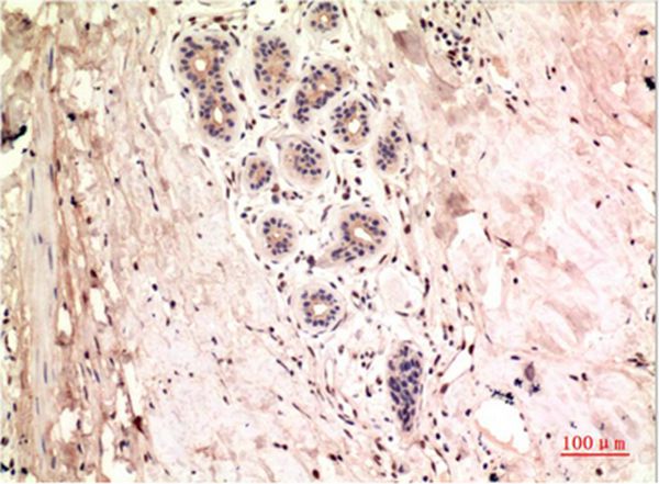 Gamma Tubulin Mouse Monoclonal Antibody(4A4)