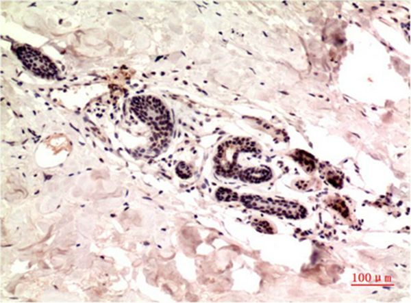 Gamma Tubulin Mouse Monoclonal Antibody(7C1)