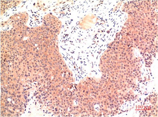 Epsilon Tubulin Mouse Monoclonal Antibody(3G1)