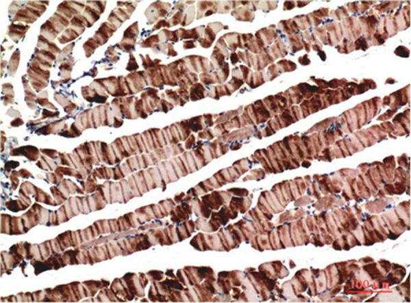 Muscle actin Mouse Monoclonal Antibody(3E9)