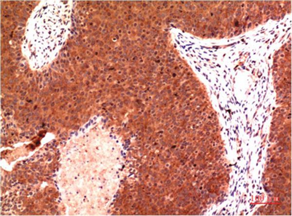 Gamma Tubulin Mouse Monoclonal Antibody(7B1)