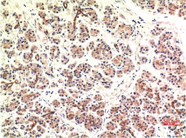 CHOP Mouse Monoclonal Antibody(2B1)