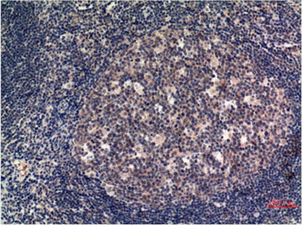 MLKL Mouse Monoclonal Antibody(8H7)