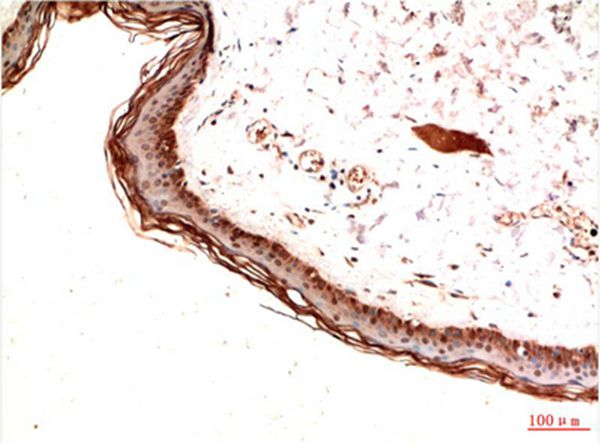 PDGFRα Mouse Monoclonal Antibody(7A3)