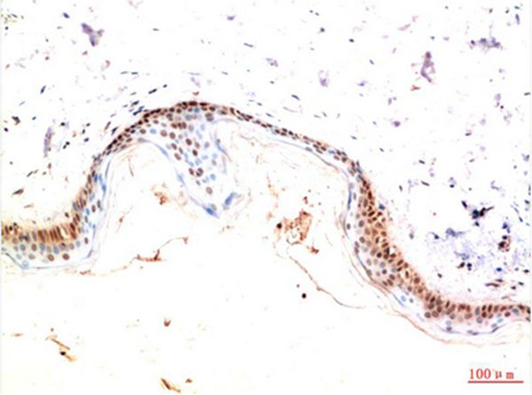 PDGFRα Mouse Monoclonal Antibody(4G11)