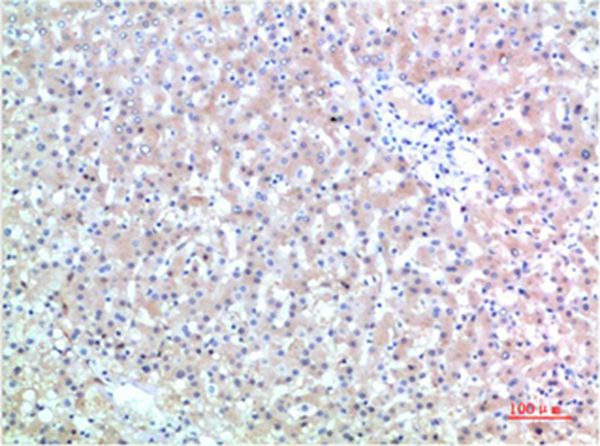 TTR Mouse Monoclonal Antibody(9A6)