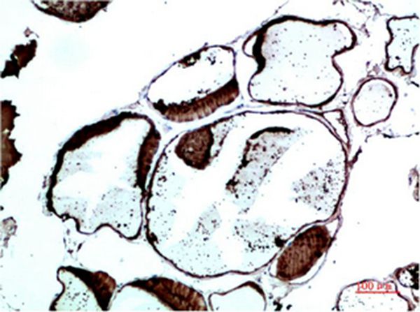 TTR Mouse Monoclonal Antibody(9D9)