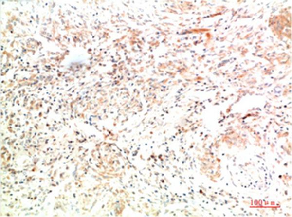 Collagen II Mouse Monoclonal Antibody(8F6) 