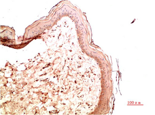 Collagen IV Mouse Monoclonal Antibody(5E10)