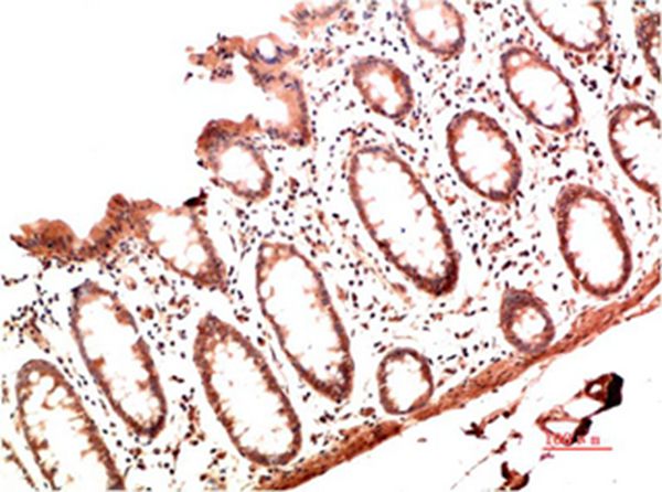 Collagen I Mouse Monoclonal Antibody(1B2)