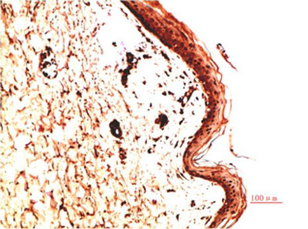 Collagen IV Mouse Monoclonal Antibody(5C9)