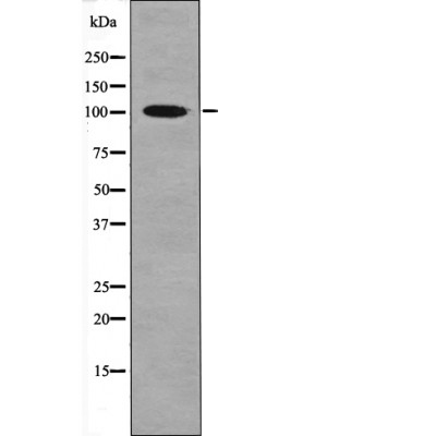 CTIP (Phospho-Ser327) Antibody