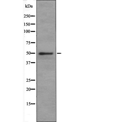 Doublecortin (Phospho-Ser378) Antibody