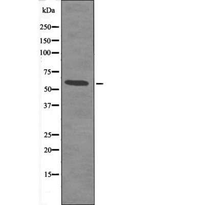 Smad2 (Phospho-Ser245) Antibody