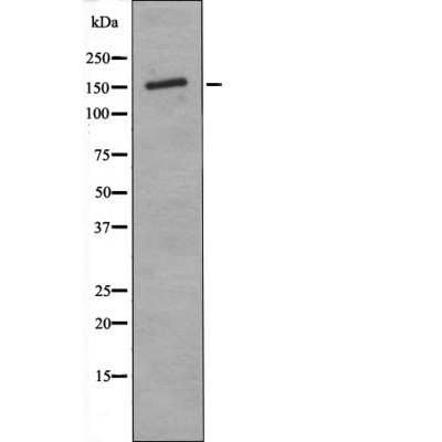 ASK1 (Phospho-Thr838) Antibody